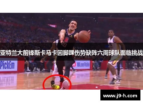 亚特兰大前锋斯卡马卡因脚踝伤势缺阵六周球队面临挑战 亚特兰大前锋斯卡马卡因脚踝伤势缺阵六周球队面临挑战